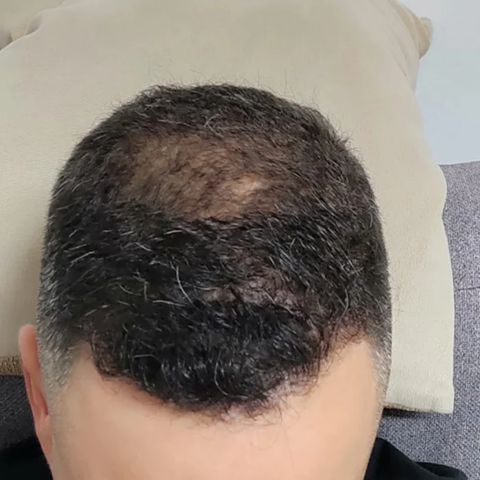 תמונת אחרי מתוך התיעוד הראשון בגלריית מיינטופ