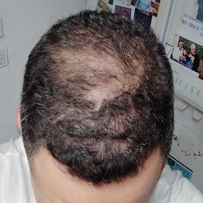 תמונת לפני מתוך התיעוד הראשון בגלריית מיינטופ